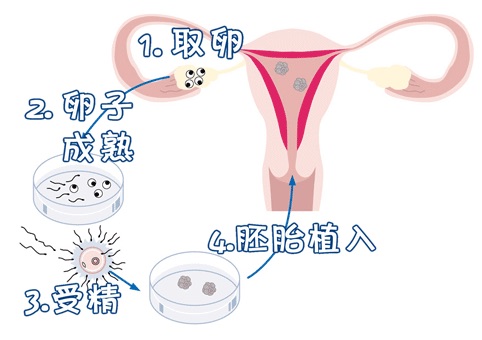 供卵代孕公司